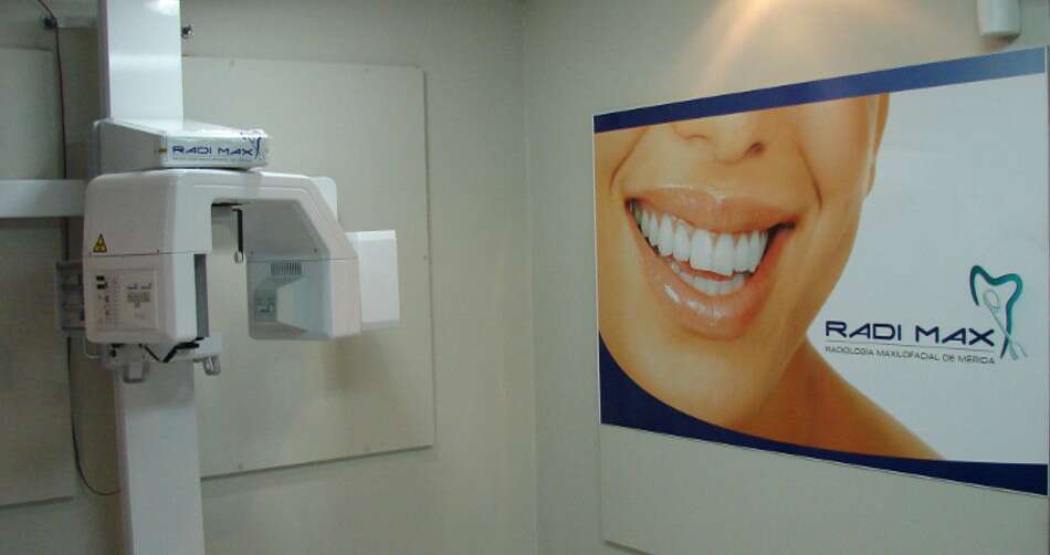 equipo-radimax-merida