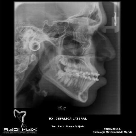 radiografia-cefalica-lateral