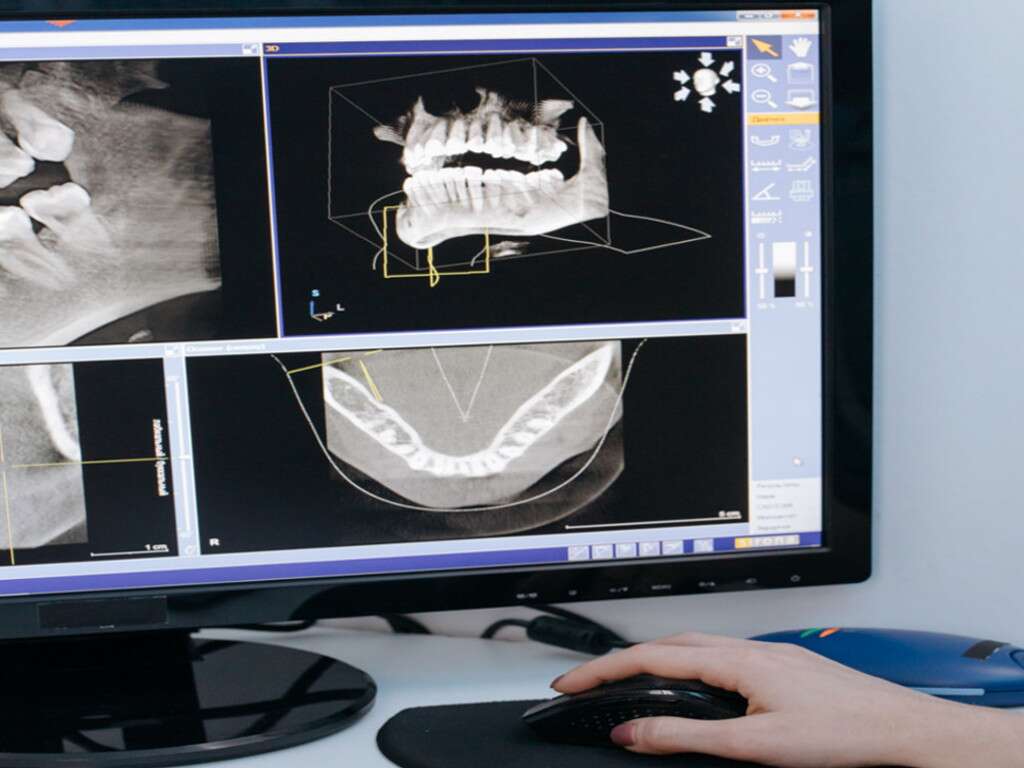 radiografia-dental-intraoral
