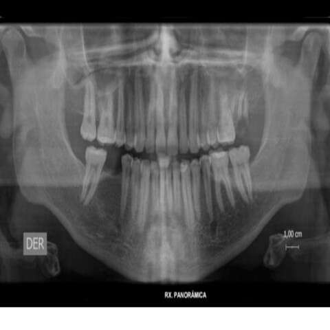 panoramica-dental