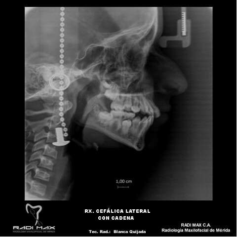 radiografia-cefalica-concadena