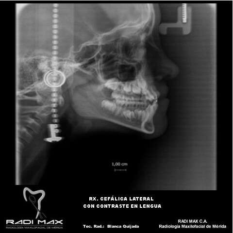 radiografia-cefalica-contraste