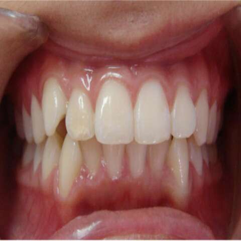 fotografia-oclusal-frente