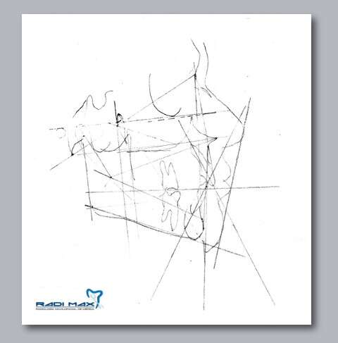 analisis-cefalometrico