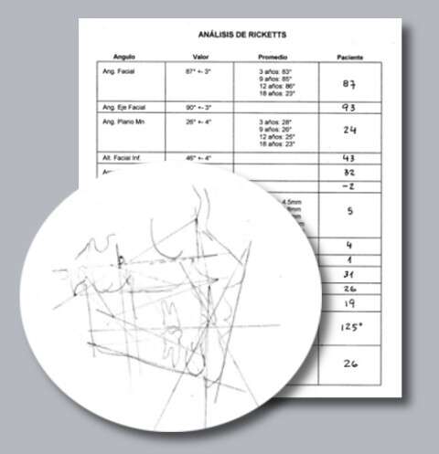 analisis-cefalometrico