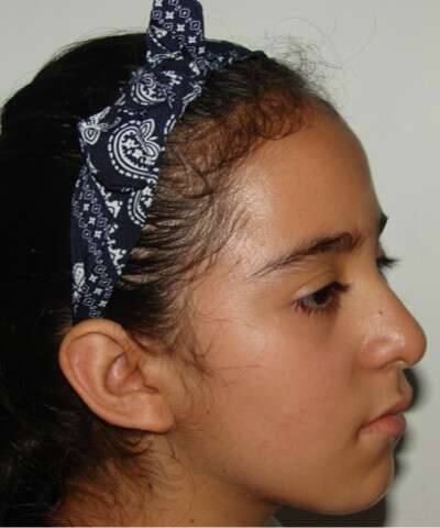 fotografia-3-4